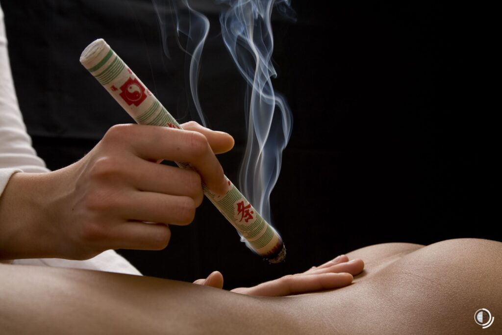 moxibustion